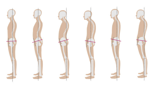 Side-view diagram comparing postures with different pelvic tilts and spine alignments